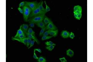 Immunofluorescence staining of HepG2 cells with ABIN7164836 at 1:100, counter-stained with DAPI. (PCSK9 anticorps  (AA 462-595))