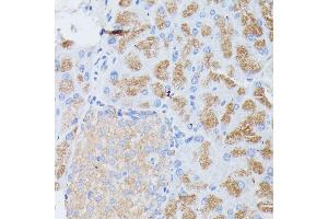 Immunohistochemistry of paraffin-embedded mouse pancreas using PLG1B antibody (ABIN6129428, ABIN6145724, ABIN6145725 and ABIN6221143) at dilution of 1:100 (40x lens). (PLA2G1B anticorps  (AA 23-148))