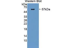 Western blot analysis of the recombinant protein. (PLEKHA1 anticorps  (AA 105-351))