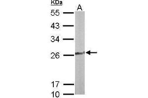 WB Image Sample (50 ug of whole cell lysate) A: Mouse liver 12% SDS PAGE antibody diluted at 1:1000 (TPK1 anticorps)