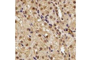 Immunohistochemical analysis of SMYD1 staining in rat kidney formalin fixed paraffin embedded tissue section. (SMYD1 anticorps)