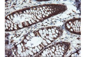 Image no. 4 for anti-PYD and CARD Domain Containing (PYCARD) antibody (ABIN1500518)