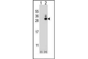 Western blot analysis of MOBKL1B (arrow) using MOBKL1B Antibody (N-term) Cat. (MOB1A anticorps  (N-Term))