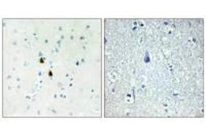 Immunohistochemistry analysis of paraffin-embedded human brain tissue, using TPD52 antibody. (PKIA anticorps)