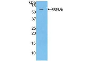 Western blot analysis of recombinant Human CFD. (Adipsin anticorps  (AA 1-253))
