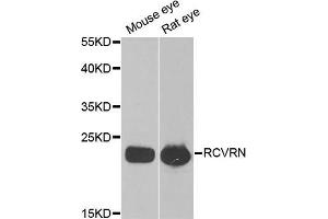 Western blot analysis of extracts of various cell lines, using RCVRN antibody (ABIN5973805) at 1/1000 dilution. (Recoverin anticorps)
