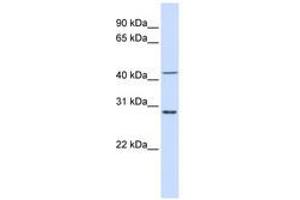 Image no. 1 for anti-Ribosomal Protein L3 (RPL3) (AA 36-85) antibody (ABIN6741022) (RPL3 anticorps  (AA 36-85))