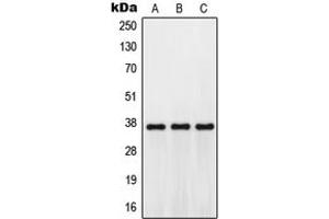 Western blot analysis of GPR171 expression in Jurkat (A), mouse kidney (B), H9C2 (C) whole cell lysates. (GPR171 anticorps  (Center))