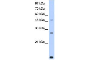 WB Suggested Anti-CNOT7 Antibody Titration:  0. (CNOT7 anticorps  (N-Term))