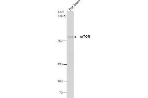 WB Image mTOR antibody [C1], Internal detects mTOR protein by western blot analysis. (MTOR anticorps  (Internal Region))