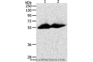 Western blot analysis of Human colon and ovarian cancer tissue, using MMP11 Polyclonal Antibody at dilution of 1:600