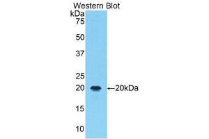 Western Blotting (WB) image for anti-Arachidonate 5-Lipoxygenase (ALOX5) (AA 374-536) antibody (ABIN1174531) (ALOX5 anticorps  (AA 374-536))