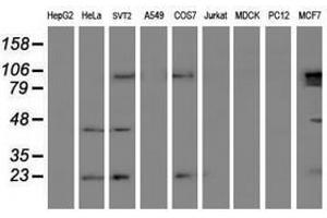 Image no. 2 for anti-Ubiquitin-Conjugating Enzyme E2E 3 (UBE2E3) antibody (ABIN1501616) (UBE2E3 anticorps)