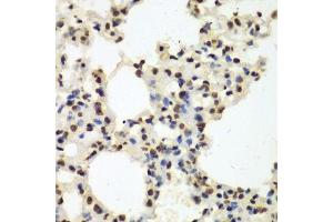 Immunohistochemistry of paraffin-embedded mouse lung using Nono Antibody. (NONO anticorps  (AA 1-300))