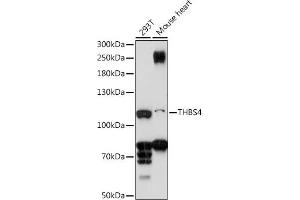 Western blot analysis of extracts of various cell lines, using THBS4 antibody (ABIN7270818) at 1:1000 dilution.