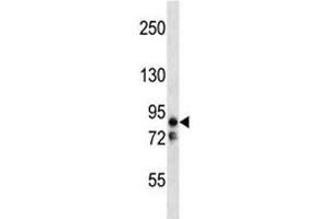 MARK2 anticorps  (AA 600-630)