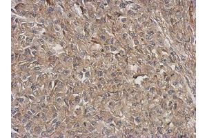 Image no. 1 for anti-Actin Related Protein 2/3 Complex, Subunit 5-Like (ARPC5L) (AA 1-153) antibody (ABIN1501988)