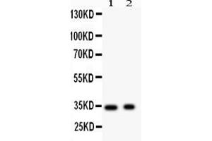Anti- Synaptophysin Picoband antibody, Western blottingAll lanes: Anti Synaptophysin  at 0. (Synaptophysin anticorps  (N-Term))