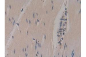 Detection of NSE in Human Rectum Tissue using Polyclonal Antibody to Enolase, Neuron Specific (NSE)