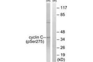 Western blot analysis of extracts from NIH-3T3 cells treated with UV 15', using Cyclin C (Phospho-Ser275) Antibody. (Cyclin C anticorps  (pSer275))