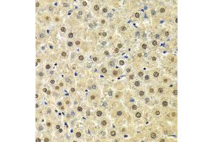 Immunohistochemistry of paraffin-embedded Rat liver using SPHK1 antibody at dilution of 1:100 (x400 lens).