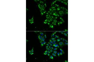 Immunofluorescence analysis of U2OS cells using TSHB antibody. (TSHB anticorps)