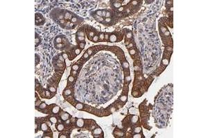Immunohistochemical staining of human small intestine with ZNF780B polyclonal antibody  shows strong cytoplasmic and membranous positivity in glandular cells at 1:20-1:50 dilution. (ZNF780B anticorps)