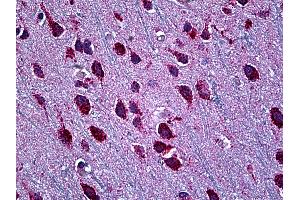 Anti-SMARCD2 antibody IHC of human brain, cortex. (SMARCD2 anticorps  (AA 398-475))