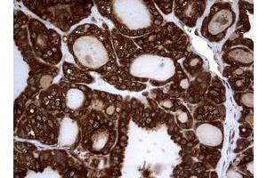 Image no. 8 for anti-Non-Metastatic Cells 1, Protein (NM23A) Expressed in (NME1) antibody (ABIN1499754)