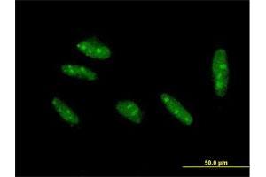 Immunofluorescence of purified MaxPab antibody to KLF15 on HepG2 cell. (KLF15 anticorps  (AA 1-416))
