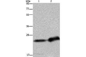 Western blot analysis of Human breast infiltrative duct and placenta tissue, using CSH1 Polyclonal Antibody at dilution of 1:300