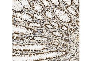 IHC analysis of DDX5 using anti-DDX5 antibody (ABIN7602561). (DDX5 anticorps  (AA 85-328))