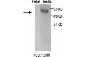 Image no. 1 for anti-Estrogen Receptor 2 (ESR2) antibody (ABIN790795) (ESR2 anticorps)