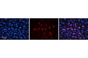 Rabbit Anti-GNL3L Antibody  Catalog Number: ARP58798_P050 Formalin Fixed Paraffin Embedded Tissue: Human Adult Liver  Observed Staining: Nuclear in hepatocytes, moderate signal, low tissue distribution Primary Antibody Concentration: 1:100 Secondary Antibody: Donkey anti-Rabbit-Cy3 Secondary Antibody Concentration: 1:200 Magnification: 20X Exposure Time: 0.