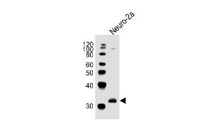 Anti-EN2Antibody (C-term)at 1:1000 dilution + Neuro-2a whole cell lysates Lysates/proteins at 20 μg per lane.