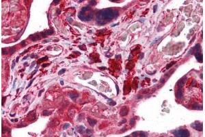 Human Placenta: Formalin-Fixed, Paraffin-Embedded (FFPE)