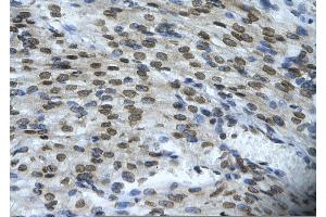 Rabbit Anti-BAX Antibody     AV  Paraffin Embedded Tissue:  Human cardiac cell   Cellular Data:  Epithelial cells of renal tubule  Antibody Concentration:   4. (BAX anticorps  (N-Term))