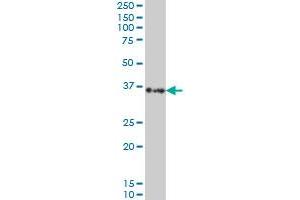SORD monoclonal antibody (M01), clone 4D3 Western Blot analysis of SORD expression in Hela S3 NE .