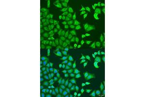 Immunofluorescence analysis of U2OS cells using CAPZB antibody. (CAPZB anticorps  (AA 1-272))