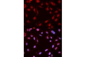 Immunofluorescence analysis of MCF7 cell using Phospho-CHEK1-S280 antibody. (CHEK1 anticorps  (pSer280))