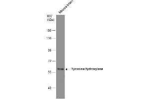 WB Image Mouse tissue extract (50 μg) was separated by 7. (Tyrosine Hydroxylase anticorps)