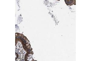 Immunohistochemical staining of human colon with TRIP4 polyclonal antibody  shows cytoplasmic positivity in glandular cells. (TRIP4 anticorps)