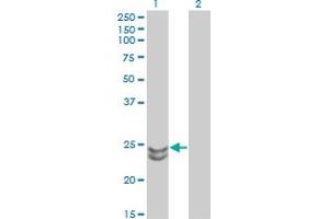 Western Blot analysis of RAB27A expression in transfected 293T cell line by RAB27A monoclonal antibody (M02), clone 1G7.
