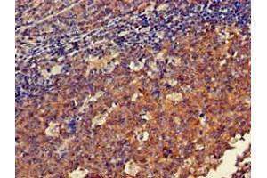 Immunohistochemistry of paraffin-embedded human tonsil tissue using ABIN7150570 at dilution of 1:100 (DOK3 anticorps  (AA 1-146))