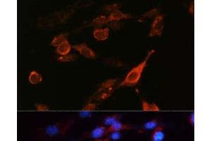 Immunofluorescence analysis of NIH-3T3 cells using CD98 Polyclonal Antibody at dilution of 1:100 (40x lens). (SLC3A2 anticorps)