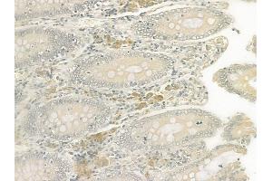 ABIN6259487 and ABIN6275046 at 1/100 staining human normal colon tissue by IHC-P.