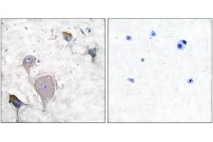 Immunohistochemistry analysis of paraffin-embedded human brain tissue, using Peripherin Antibody. (Peripherin anticorps  (AA 421-470))