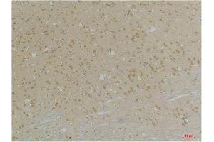 Immunohistochemistry (IHC) analysis of paraffin-embedded Rat Brain Tissue using GABA A Receptor alpha4 Rabbit Polyclonal Antibody diluted at 1:200.
