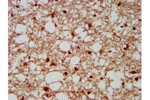IHC image of ABIN7155695 diluted at 1:300 and staining in paraffin-embedded human brain tissue performed on a Leica BondTM system. (GBX2 anticorps  (AA 65-248))