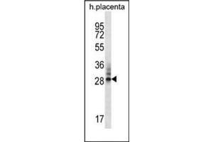 Western blot analysis of DNAJC27 / RBJ Antibody (N-term) in human placenta tissue lysates (35ug/lane). (DNAJC27 anticorps  (N-Term))